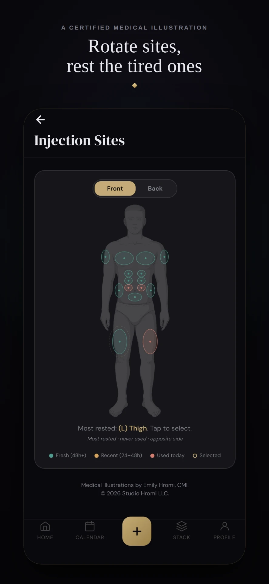 Injection sites body map with rotation history on an anatomical illustration