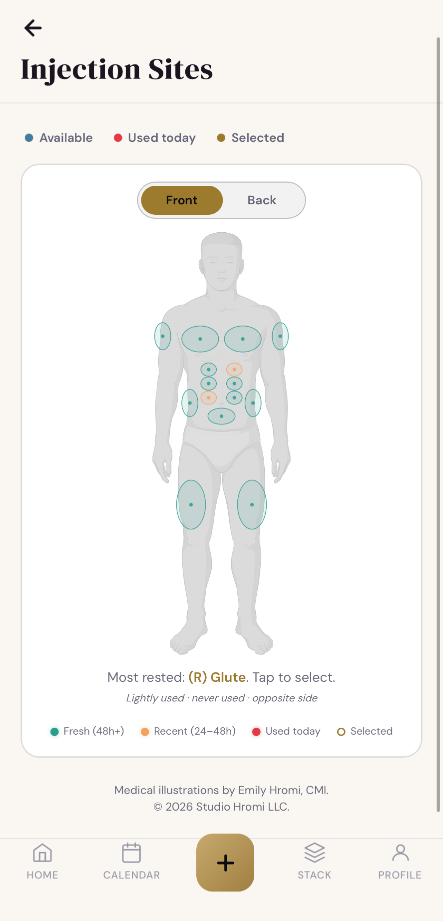 Injection sites map with rotation history on anatomical illustration